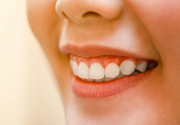 Close-up of woman's smile showing healthy white teeth and gums.
