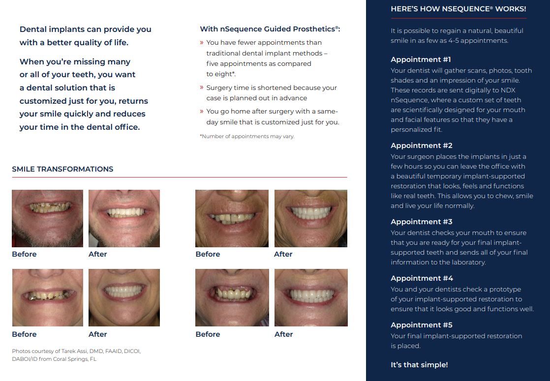 all on 4 dental implants in colorado springs