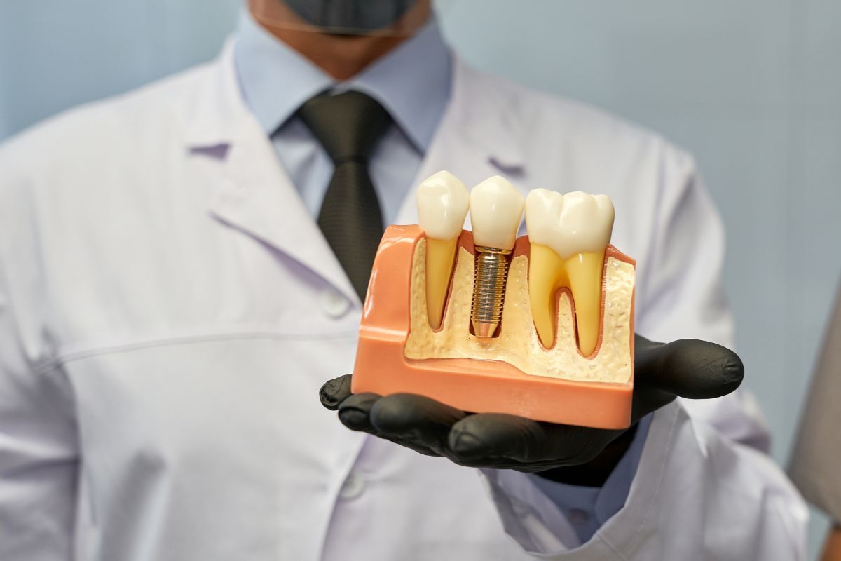 Dentist holding dental implant model showing tooth replacement with crown and screw components.